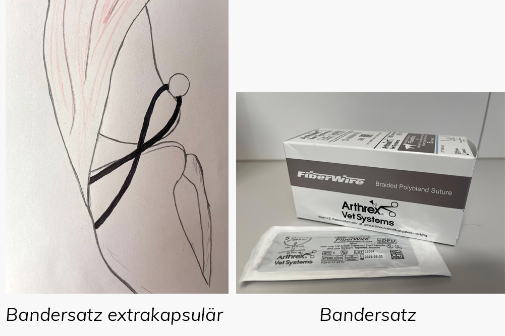 Bandersatz am Kniegelenk