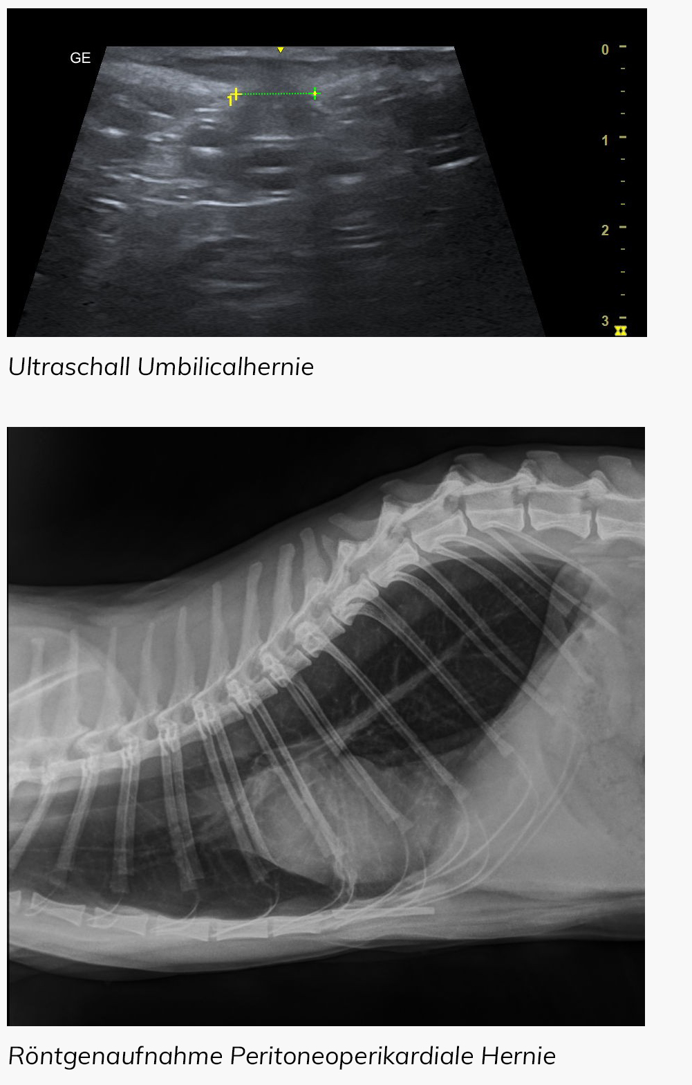 Hernienoperation